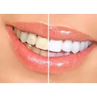 raw material liquid for white teeth  1