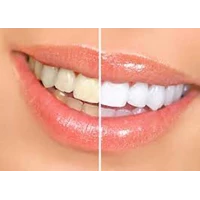 raw material liquid for white teeth 